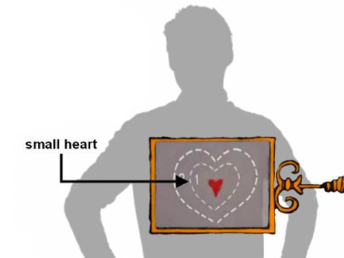 small heart xray