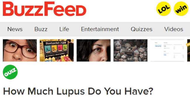 Lupus