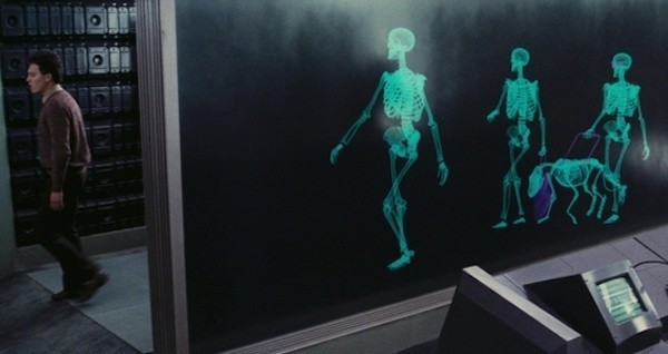 Xray total recall