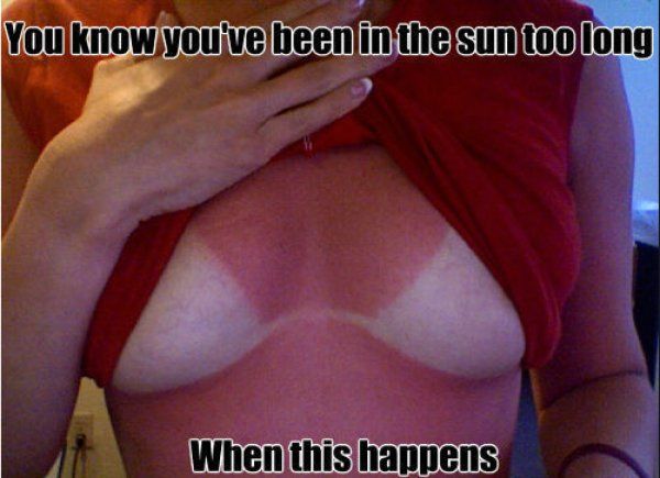 Boobs Sunburn