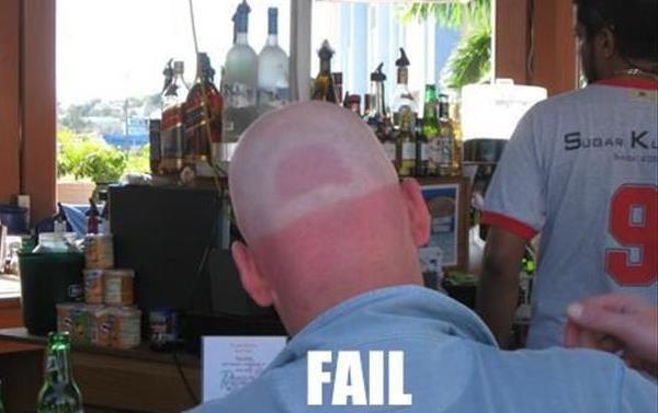 Funny Sunburns Hat