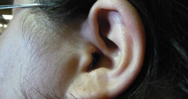 Ear